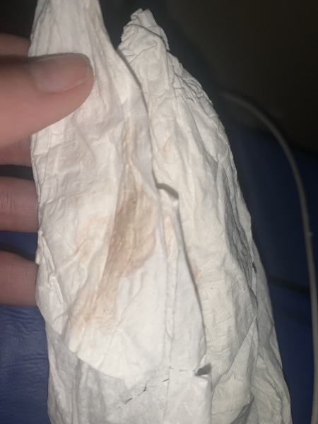 Implantation bleeding? 