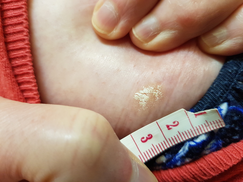 Does anyone know what this is on my boob please?