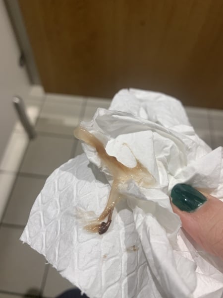 Blood when wiping