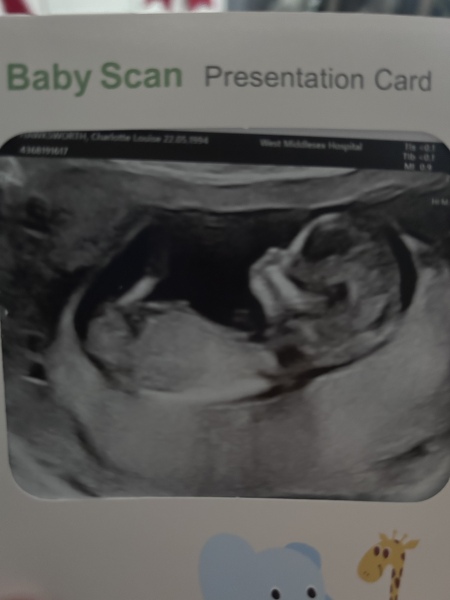 12 week nub guesses??