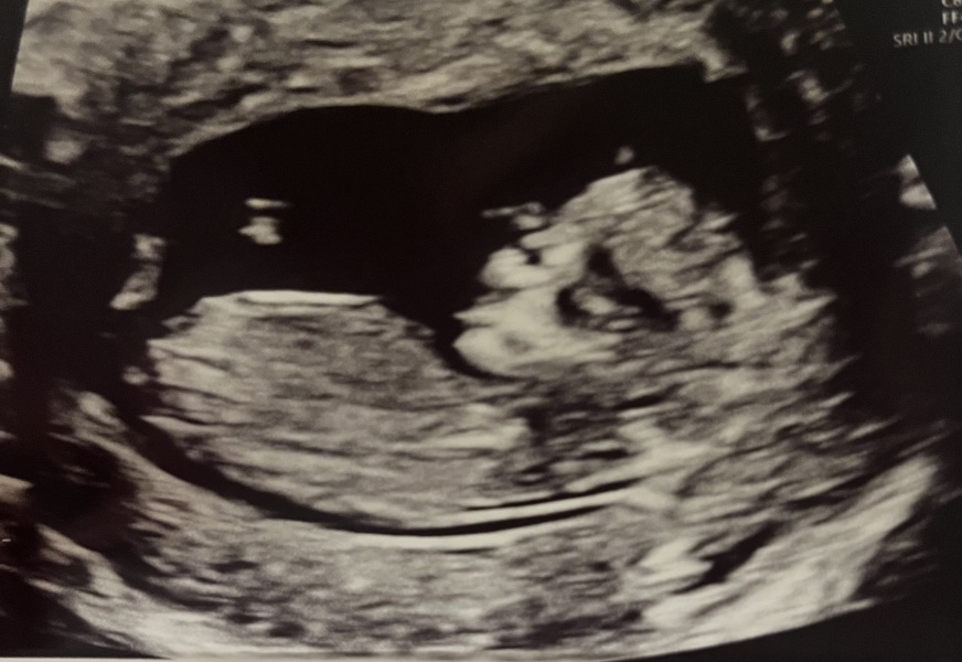 Gender guesses please :)