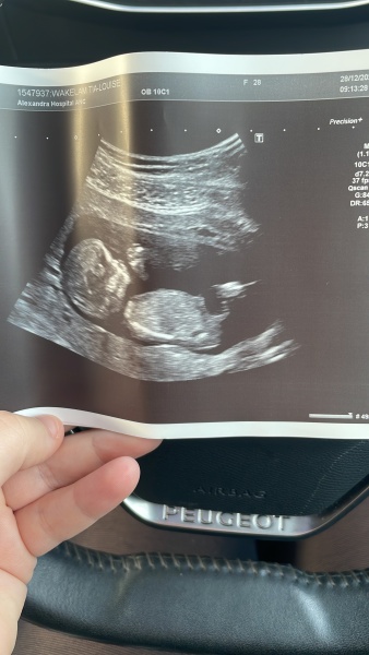 Gender guesses
