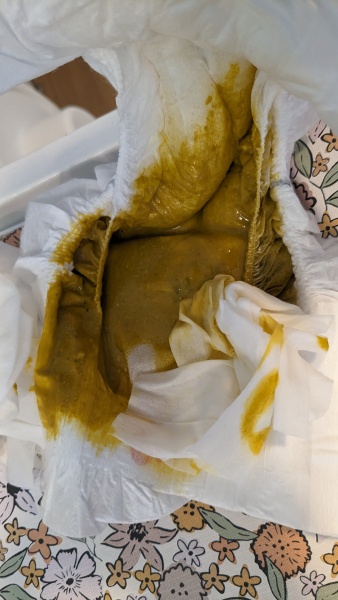 Normal baby poo? TW image!
