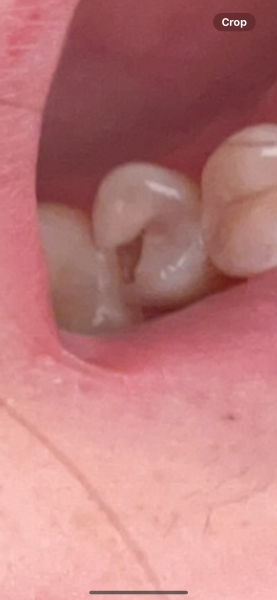 Does anyone know anything about teeth? (Bad pain)