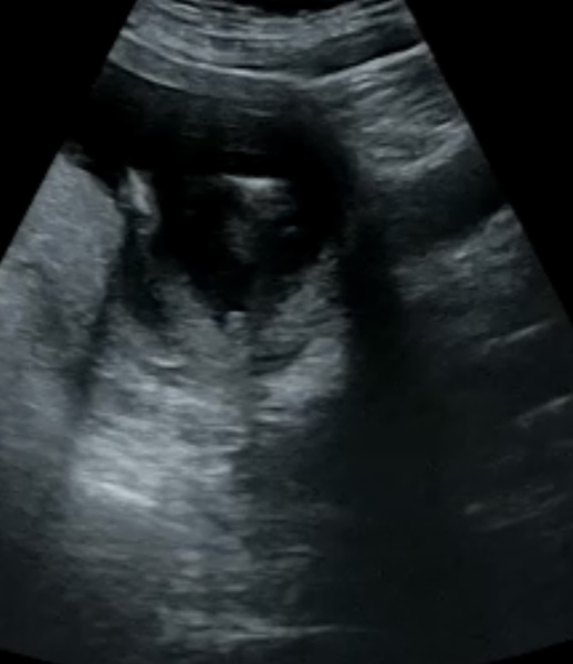 Guesses on gender