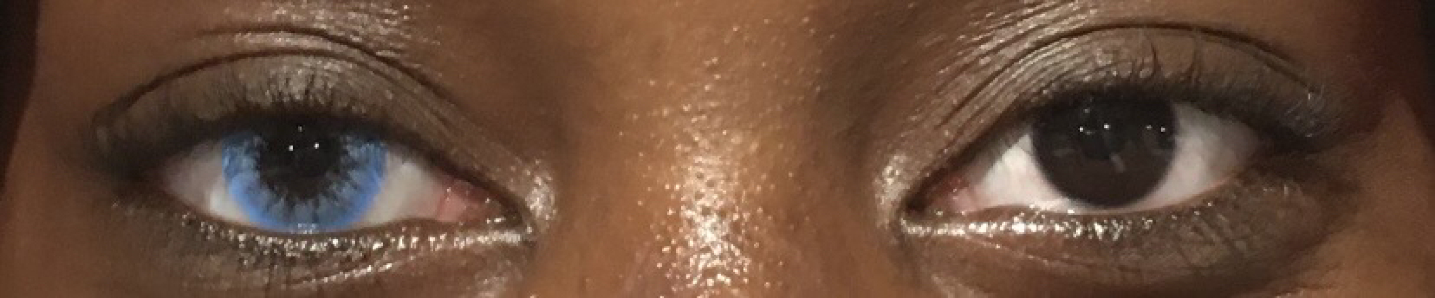 Coloured eye contacts