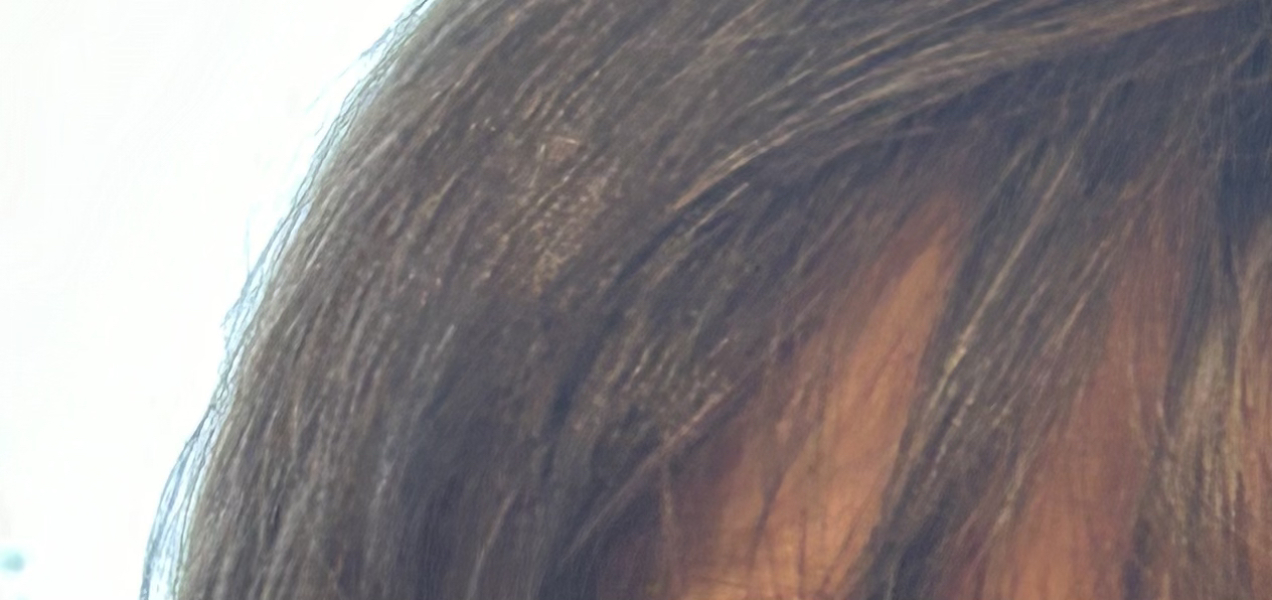 Do some people never go grey?