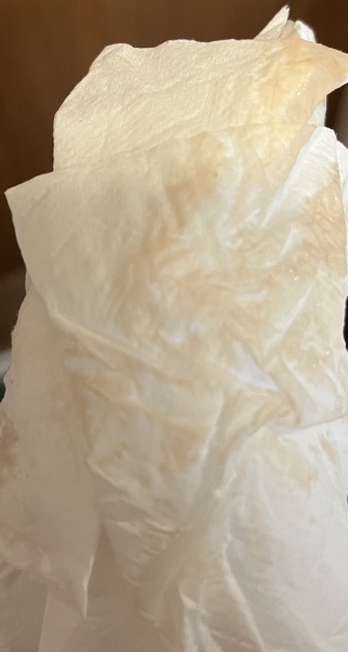*TMI PIC* what is this discharge?