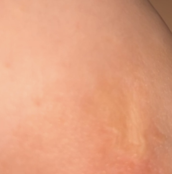 To be worried? areola And small bumps. Photo attached