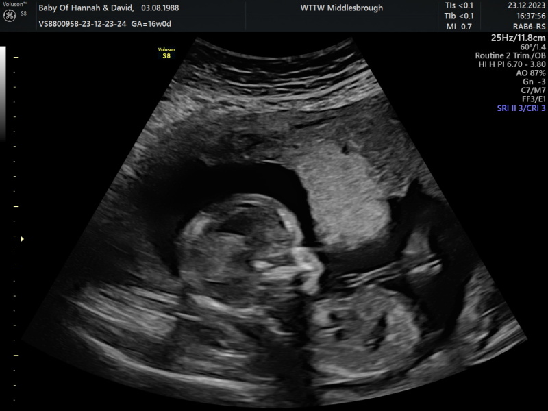 Girl? Boy? Alien?!
