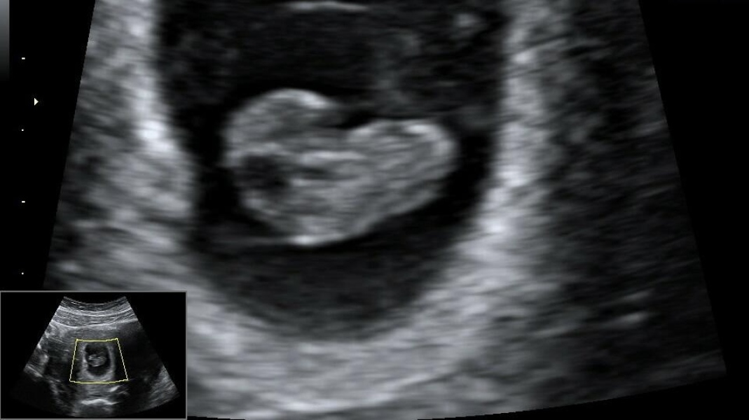 Due July 24
