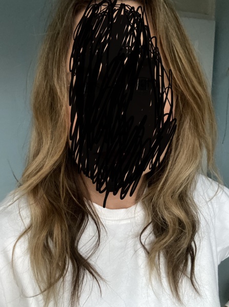 Should I dye my hair back dark ? (Pics included )