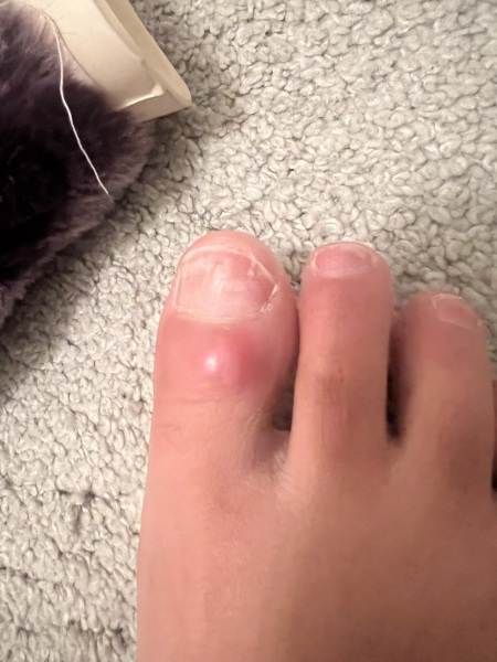 What is this on my foot?