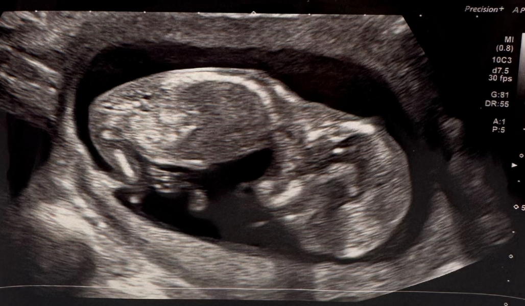 Boy or Girl 💕💙