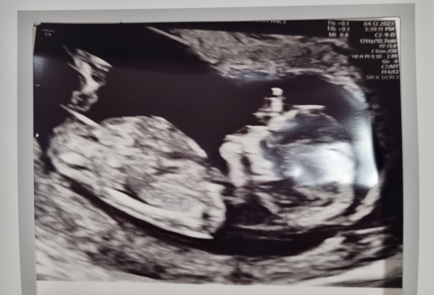 Due June 24 💚 - Part 2