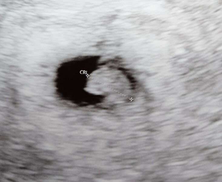 Due August 2024!