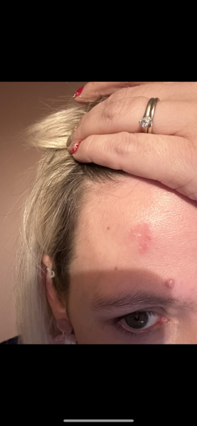 What is this rash?!