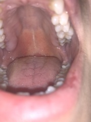 Help any dentists here? (warning grim picture!)
