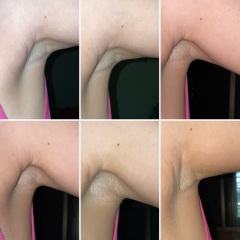 Am I delusional, or is there a bulge under my armpit?