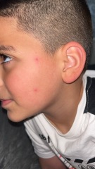 Could this be chicken pox or any idea what else it could be