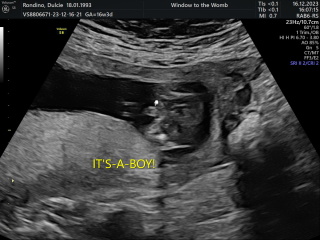 Gender guess?