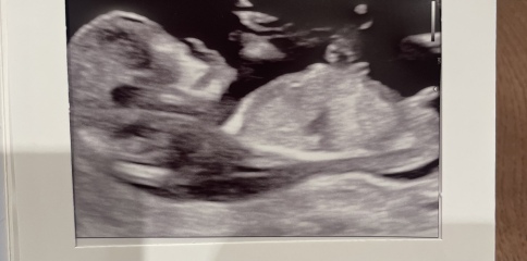 Boy or girl??