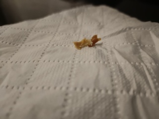 Fabulous earwax *tmi pic*