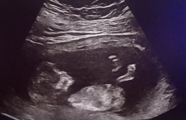 Gender guess?
