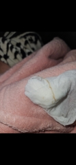 6 weeks pregnant discharge