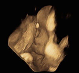Due February 2024 Thread 5!! 🤰🩷💙