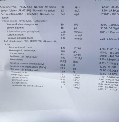Tell me your underactive thyroid symptoms?