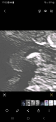 Any sonographers able to help?