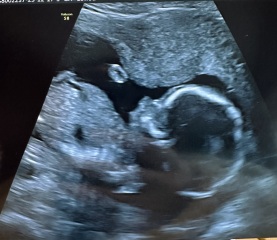 Due May 2024? Part 2