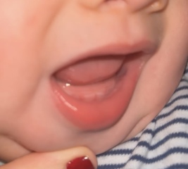 Teething?