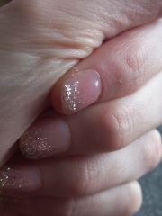 Is this normal for gel extensions?