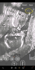 Any sonographers able to help?