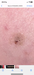 To ask you if this mole would worry you (sorry)