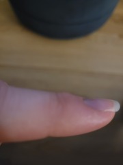 Finger lump