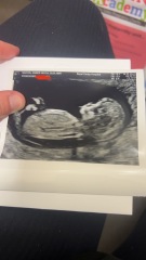 Boy or girl? 13 weeks