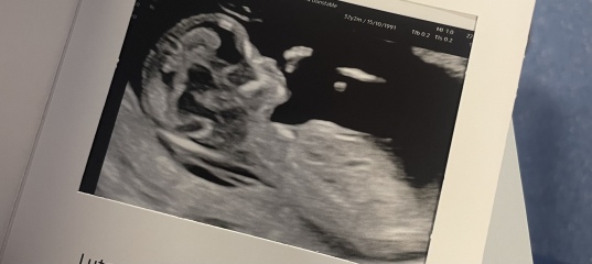 Boy or girl??