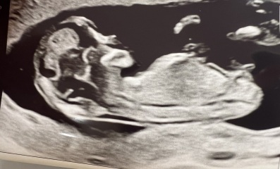 Girl or Boy 💖💙