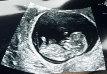 Boy or girl? 13 weeks