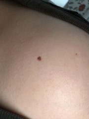 Moles