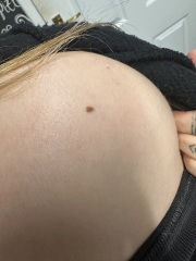 Moles