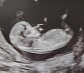 Boy or girl, any guesses?