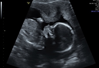Due May 2024? Part 2