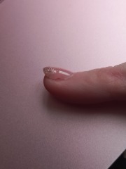 Is this normal for gel extensions?