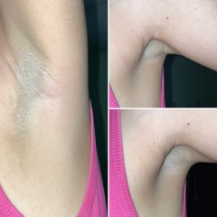Am I delusional, or is there a bulge under my armpit?