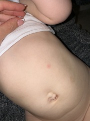 Random spots allergy?