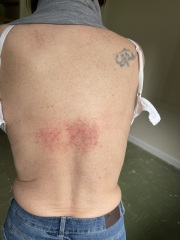 Wtf is this rash? (Pic included)
